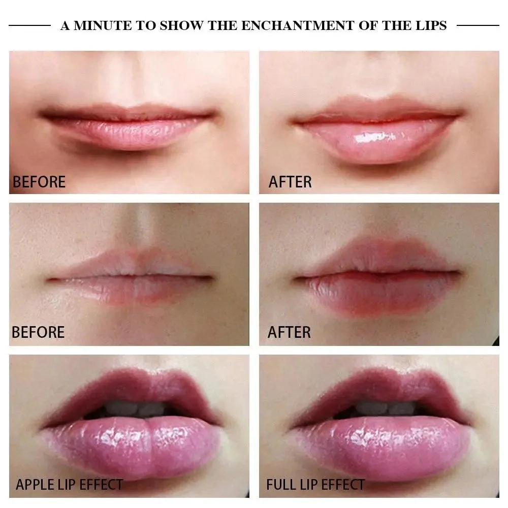 Dispositivo Premium Manual para Voluminizar Labios