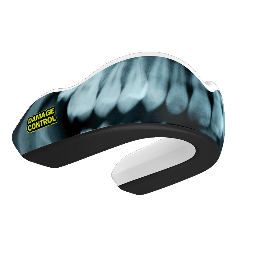 X-Ray Mouthguard (EI)