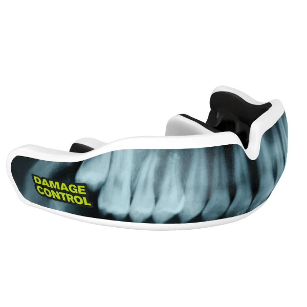 X-Ray Custom Mouthguard