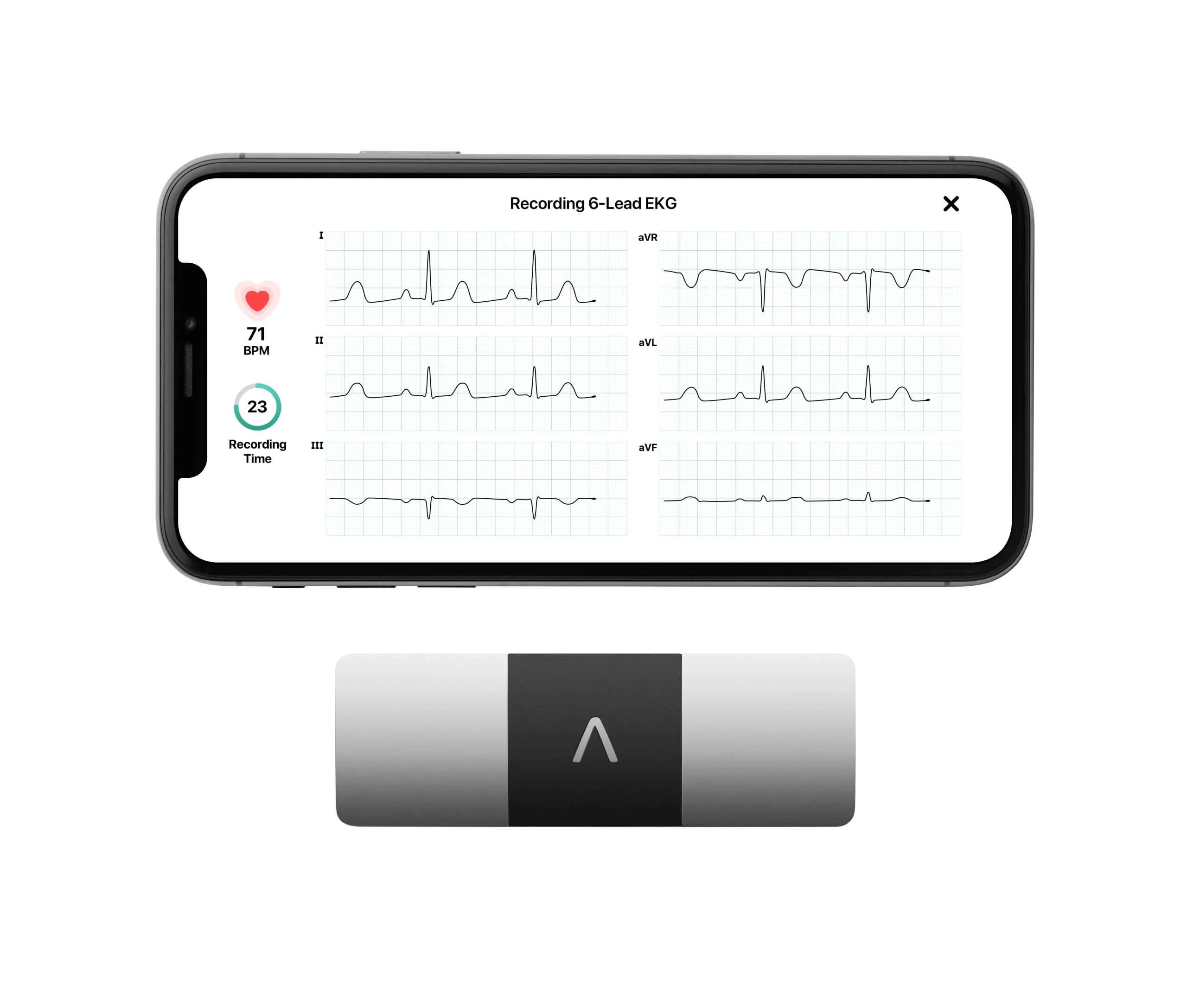 6L Personal EKG Monitor with Most Smartphones